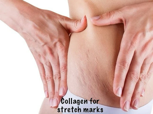 Collagen for stretch marks